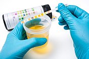 Urin Teststreifen Urin wird auf den Teststreifen aufgetragen